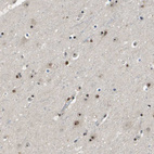 Immunohistochemical staining of human cerebral cortex shows moderate nuclear/nucleoli positivity in neurons.