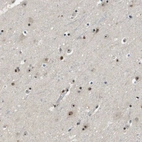 Immunohistochemical staining of human cerebral cortex shows moderate nuclear/nucleoli positivity in neurons.