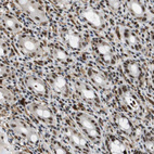 Immunohistochemical staining of human rectum shows moderate nuclear/nucleoli positivity in glandular cells.