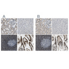 Anti-SP100 Antibody