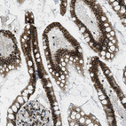 Immunohistochemical staining of human small intestine shows strong nuclear positivity in glandular cells.