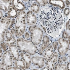 Immunohistochemical staining of human kidney shows moderate nuclear positivity in cells in tubules.