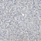 Immunohistochemical staining of human liver shows no positivity in hepatocytes as expected.