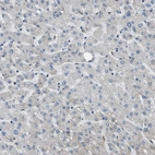 Immunohistochemical staining of human liver shows no positivity in hepatocytes as expected.