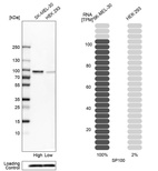 Western blot analysis in human cell lines SK-MEL-30 and HEK293 using Anti-SP100 antibody. Corresponding SP100 RNA-seq data are presented for the same cell lines. Loading control: Anti-PFN1.