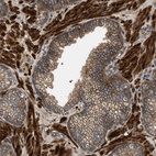 Anti-CNNM3 Antibody