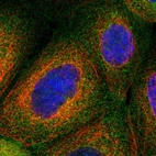 Immunofluorescent staining of human cell line A-431 shows localization to cytosol.