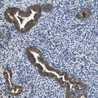 Immunohistochemical staining of human endometrium shows moderate to strong membranous positivity in glandular cells.