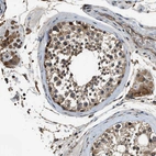 Immunohistochemical staining of human testis shows moderate to strong positivity.