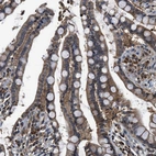 Immunohistochemical staining of human colon shows moderate to strong positivity in glandular cells.
