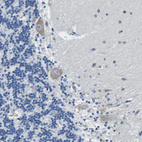 Immunohistochemical staining of human cerebellum shows moderate cytoplasmic positivity in purkinje cells.