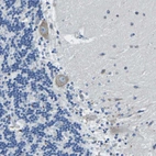 Immunohistochemical staining of human cerebellum shows moderate cytoplasmic positivity in purkinje cells.