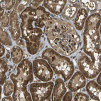 Anti-TMTC1 Antibody