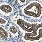 Immunohistochemical staining of human endometrium shows strong granular cytoplasmic positivity in glandular cells.