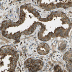 Immunohistochemical staining of human prostate shows strong granular cytoplasmic positivity in glandular cells.