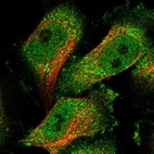 Immunofluorescent staining of human cell line U-251 MG shows localization to nucleoplasm & cytosol.