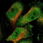 Immunofluorescent staining of human cell line U-251 MG shows localization to nucleoplasm & cytosol.