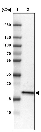 Lane 1: Marker [kDa] 250, 130, 100, 70, 55, 35, 25, 15, 10_br/_Lane 2: Human Tonsil tissue