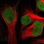 Immunofluorescent staining of human cell line U-2 OS shows localization to nucleus.