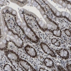 Immunohistochemical staining of human duodenum shows strong nuclear positivity in glandular cells.