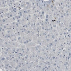 Immunohistochemical staining of human liver shows no positivity in hepatocytes as expected.