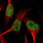 Immunofluorescent staining of human cell line U-251 MG shows localization to nucleoplasm.