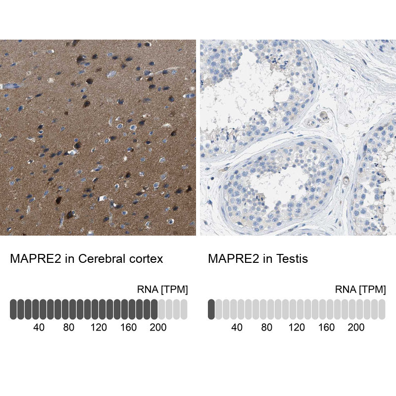 Anti-MAPRE2 Antibody