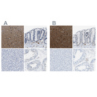 Anti-MAPRE2 Antibody