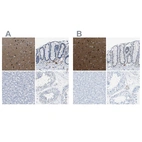 Immunohistochemical staining of human cerebral cortex, colon, liver and testis using Anti-MAPRE2 antibody HPA016738 (A) shows similar protein distribution across tissues to independent antibody HPA016739 (B).