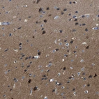 Immunohistochemical staining of human cerebral cortex shows high expression.