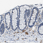 Immunohistochemical staining of human colon shows moderate cytoplasmic positivity in peripheral nerve / ganglion.
