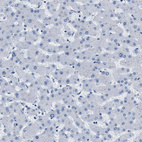 Anti-MAPRE2 Antibody