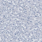 Immunohistochemical staining of human liver shows no positivity in hepatocytes as expected.