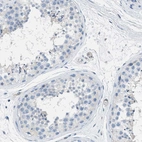Immunohistochemical staining of human testis shows no positivity in cells in seminiferous ducts as expected.