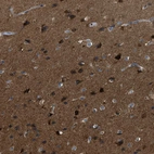 Immunohistochemical staining of human cerebral cortex shows high expression.