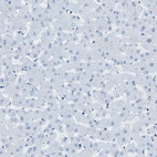 Immunohistochemical staining of human liver shows no positivity in hepatocytes as expected.