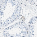 Immunohistochemical staining of human testis shows no positivity in cells in seminiferous ducts as expected.