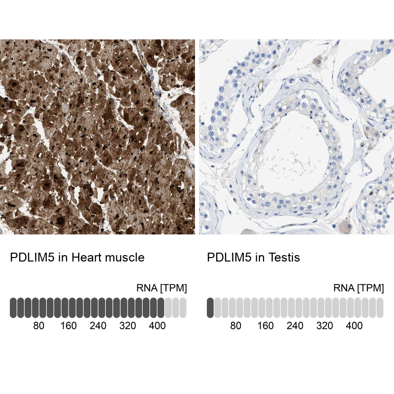Anti-PDLIM5 Antibody