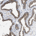 Immunohistochemical staining of human prostate shows moderate cytoplasmic positivity in glandular cells.