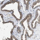 Immunohistochemical staining of human prostate shows moderate cytoplasmic positivity in glandular cells.