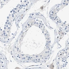 Immunohistochemical staining of human testis shows no positivity in cells in seminiferous ducts.