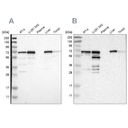 Western blot analysis using Anti-PDLIM5 antibody HPA016740 (A) shows similar pattern to independent antibody HPA020026 (B).