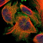 Immunofluorescent staining of human cell line U-251 MG shows localization to plasma membrane, cytosol & focal adhesion sites.