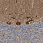 Anti-PPM1B Antibody