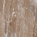 Immunohistochemical staining of human skeletal muscle shows moderate cytoplasmic positivity in myocytes.