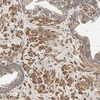 Immunohistochemical staining of human prostate shows strong cytoplasmic positivity in smooth muscle cells.