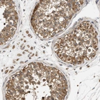 Immunohistochemical staining of human testis shows strong cytoplasmic positivity in cells in seminiferous ducts.