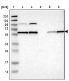 Lane 1: Marker [kDa] 230, 130, 95, 72, 56, 36, 28, 17, 11_br/_Lane 2: Human cell line RT-4_br/_Lane 3: Human cell line U-251MG sp_br/_Lane 4: Human plasma (IgG/HSA depleted)_br/_Lane 5: Human liver tissue_br/_Lane 6: Human tonsil tissue