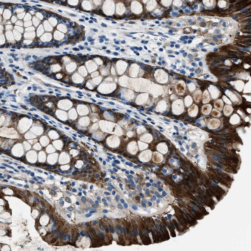 Anti-PTPDC1 Antibody