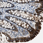 Anti-PTPDC1 Antibody